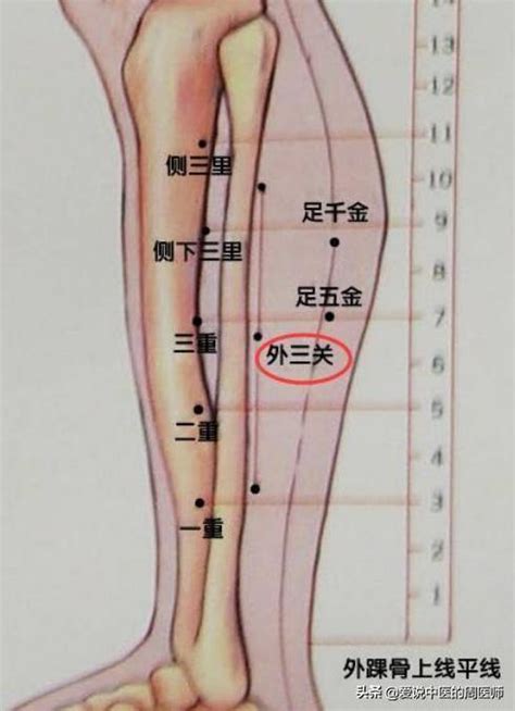 關中穴